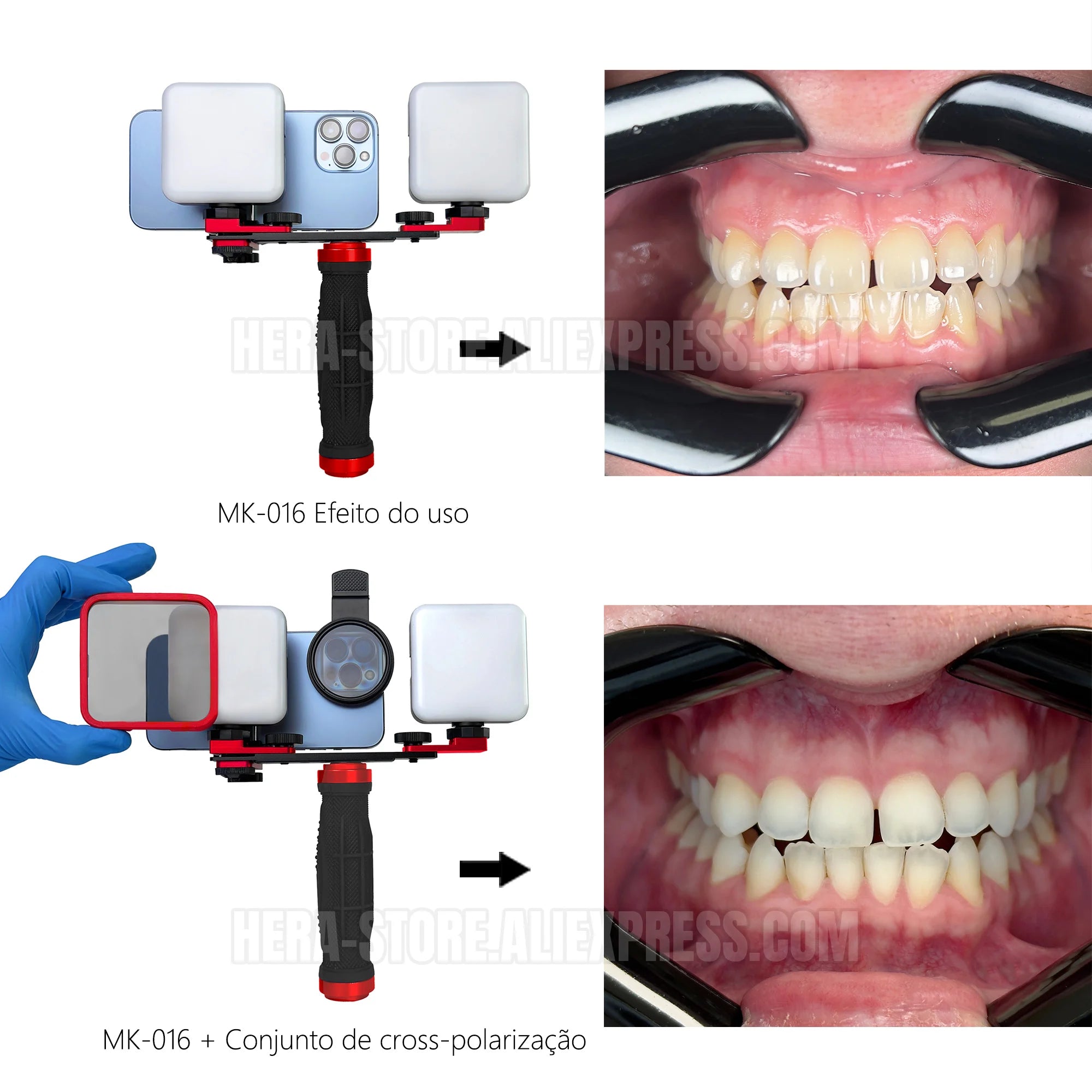 Dental Photography Light Kit Phone Compatible Dentist Teeth & Dentures Photo Lighting Dental Phone Light